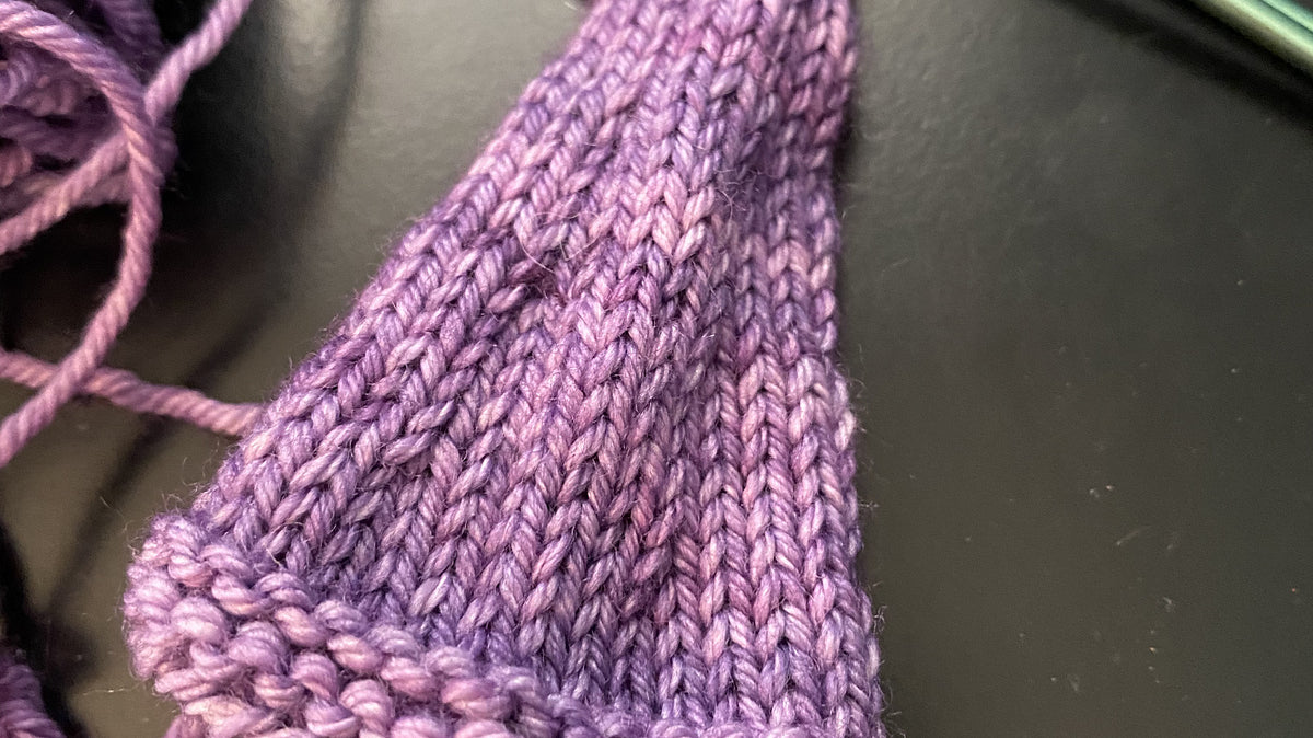 Episode 193 Gnome in a Tree